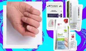 Dłoń z osłabionymi paznokciami obok produktów do ich regeneracji. Zestaw kosmetyków do regeneracji paznokci.