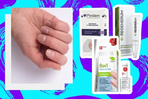 Dłoń z osłabionymi paznokciami obok produktów do ich regeneracji. Zestaw kosmetyków do regeneracji paznokci.