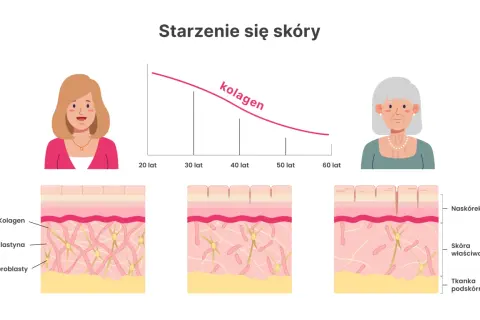 Wykres pokazuje, jak spada poziom kolagenu w skórze z wiekiem. Ilustracja pokazuje zmiany w strukturze skóry, gdzie kolagen odgrywa kluczową rolę.